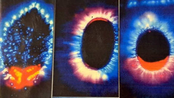 KIRLIAN